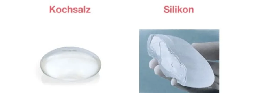 Brustimplantat aus Kochsalz oder Silikon